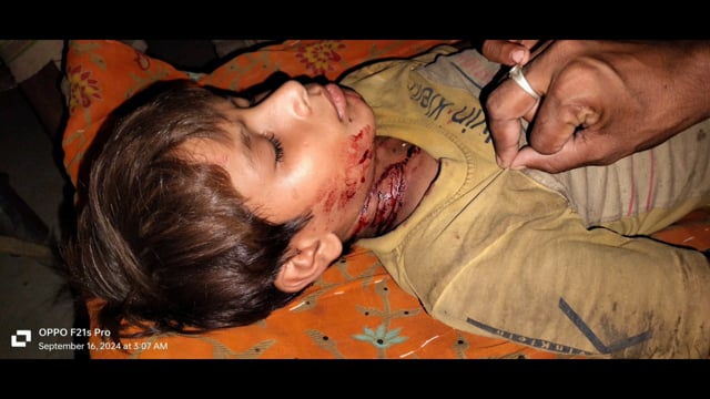 Bahraich,:S भेड़िया ने फिर एक बार एक मासूम पर किया हमला