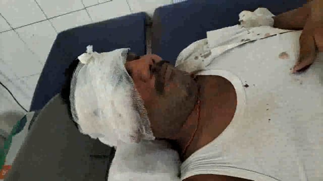 अमेठी -भेटुआ चौराहे में भीषण एक्सीडेंट तीन व्यक्ति गंभीर रूप से घायल 2को गजेंद्र पांडेय,अच्छेलाल लखनऊ ट्रामा सेंटर रेफर 