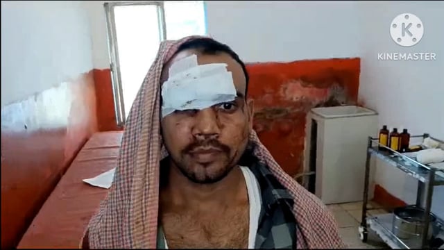 अमरपुर थाना क्षेत्र के मादाचक मोड़ के समीप बाइक एवं ऑटो की टक्कर में बाइक सवार तीन जख्मी।