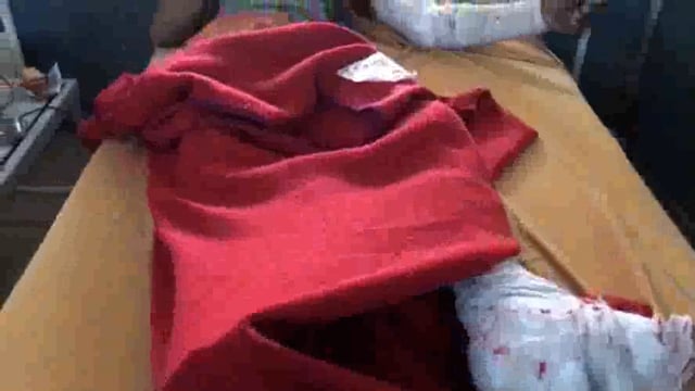 काम के दौरान गिरा मजदूर ठेकेदार अस्पताल में छोड़कर भागा