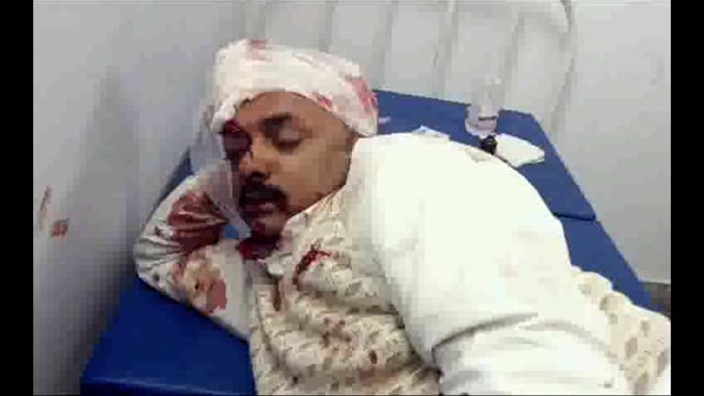 आमने-सामने की टक्कर में दो जख्मी; भागलपुर रेफर 