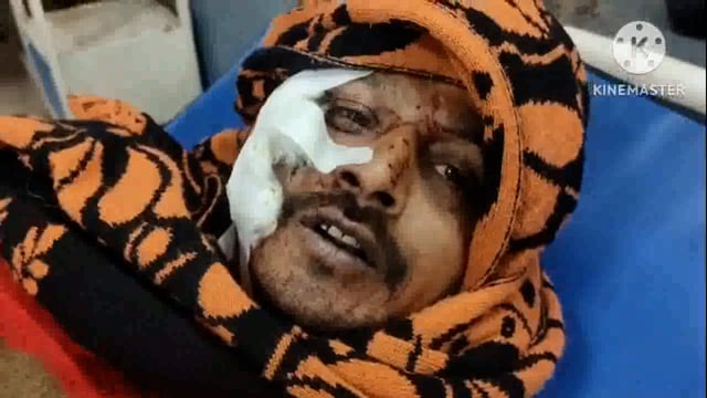 थाना कोतवाली के भूतेश्वर चौराहे के समीप ई रिक्शा चालक को ट्रैक्टर ने मारी टक्कर दो घायल अस्पताल में कराया भर्ती 