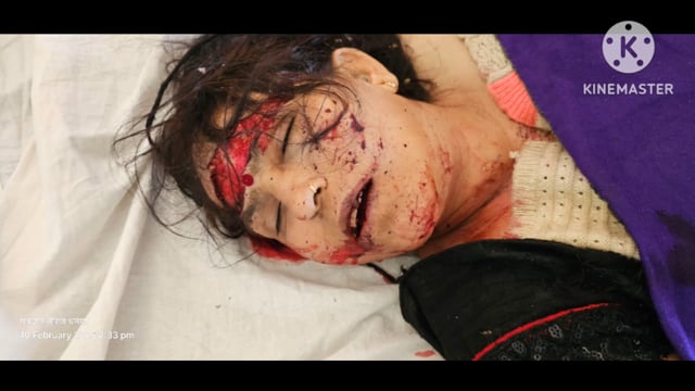 डंपर और कार में हुई भीषण टक्कर कार में बैठे चार लोगों की हुई मौत