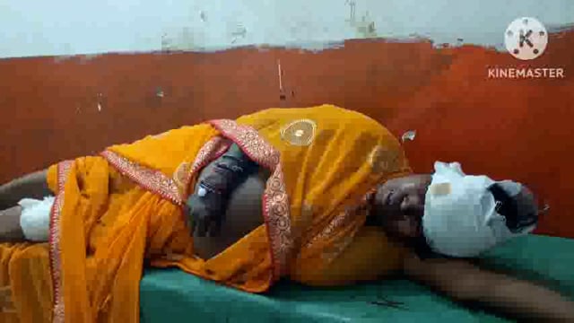 स्पीड ब्रेकर पर बाइक पलटने से महिला गंभीर रूप से जख्मी ।प्राथमिक उपचार के बाद भागलपुर रेफर् ।