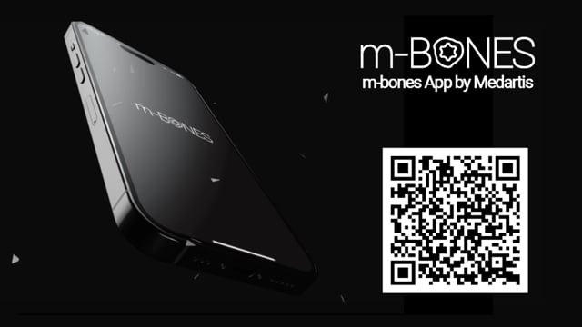 Medartis BONES - Trailer