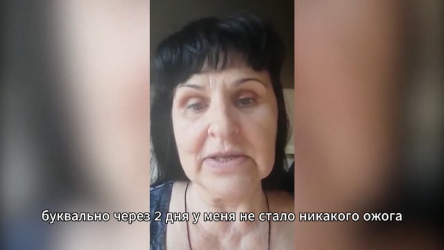 Быстрое избавление от ожога на плече. Родинка высохла и отпала