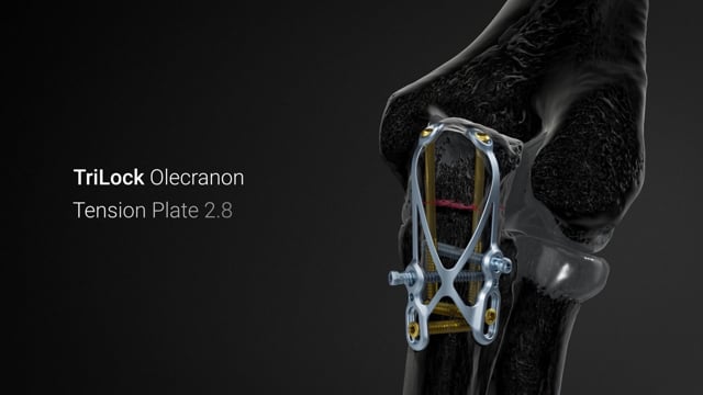 APTUS Elbow Olecranon Solutions
