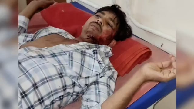 पिनाहट। दो बाइकों में आमने-सामने से भिड़ंत तीन घायल 