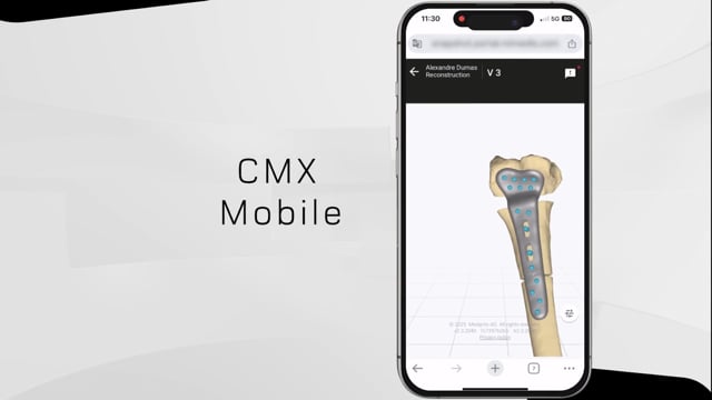 CMX Mobile Version Teaser