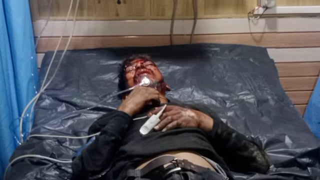 रोडक्रॉस करते युवक को डंपर ने मारी टक्कर स्कूटी सवारों ने किया कई किलोमीटर तक का पीछा डम्फर के नम्बर की दी जानकारी