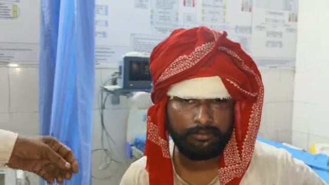 इंद्रानगर वार्ड नंबर 01 में दुकान को लेकर हुई दो पक्षो में मारपीट 04 घायल