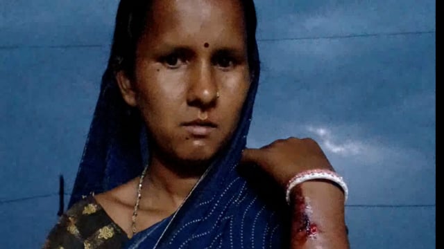 आनंदपुर थाना क्षेत्र के नावाडीह गांव की एक महिला सावित्री देवी को गांव के चार लोगों ने मारपीट कर किया जख्मी:दी आवेदन 