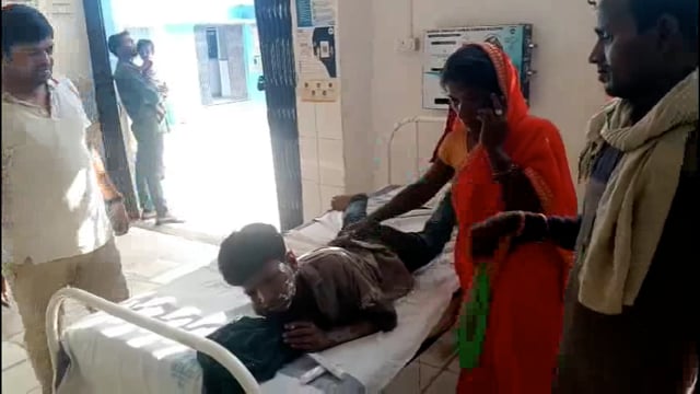 गैस लीक होने से 12 वर्षीय किशोर का चेहरा झुलसा।