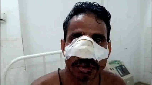 बच्चों के बीच चम्मच को लेकर हुए झगड़े में बड़े भाई ने छोटे भाई पर किया जानलेवा हमला।