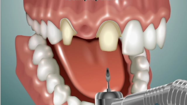 testimonial-1 patient-Bridges