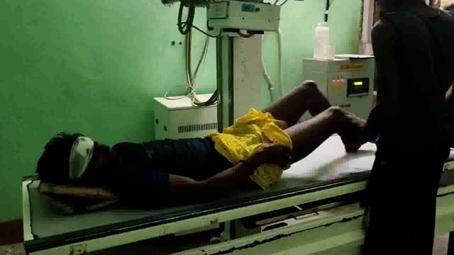 कठेल गांव के पास ऑटो पलटने से युवक गंभीर रूप से जख्मी।