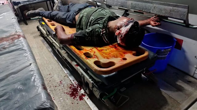 पिनाहट। सड़क हादसे कांस्टेबल गंभीर रूप से घायल , आगरा किया गया रेफर 