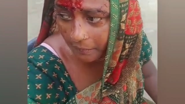 पति पत्नी से एक ही परिवार के लोगों ने की मारपीट