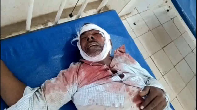 गंभीर रूप से घायल व्यक्ति को ई रिक्शा चालक ने पहुंचाया अस्पताल घायल व्यक्ति की नहीं हो सकी है पहचान।