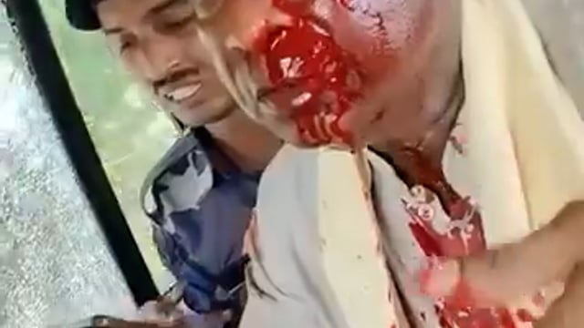 ➡️.....पश्चिम बंगाल में बीजेपी सांसद पर हमला, सिर में चोट से हुए लहूलुहान; भीड़ ने गाडियां भी तोड़ीं*

_पश्चिम बंगाल के जलपाईगुड़ी में बीजेपी सांसद खगेन मुर्मु पर जानलेवा हमला हुआ है। उत्तरी बंगाल में मालदा के नागराकाटा में उनके काफिले पर पत्थर चप्पल जूते और लाठी-डंडों से हमला किया गया।