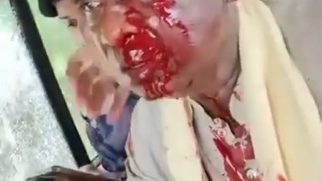 पश्चिम बंगाल में बीजेपी सांसद पर हमला, सिर में चोट से हुए लहूलुहान; भीड़ ने गाडियां भी तोड़ीं*
#politics