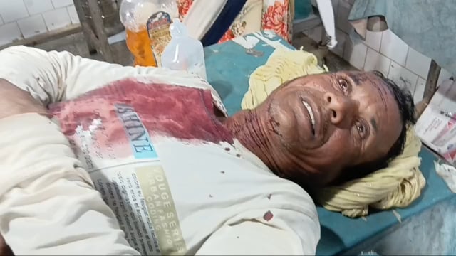 शेरपुर गांव में हुई मारपीट की घटना में दो लोग हुए जख्मी पीएचसी में किया गया इलाज
