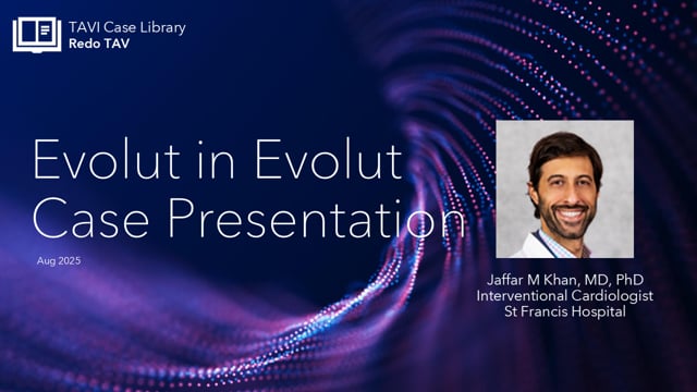 Evolut in Evolut