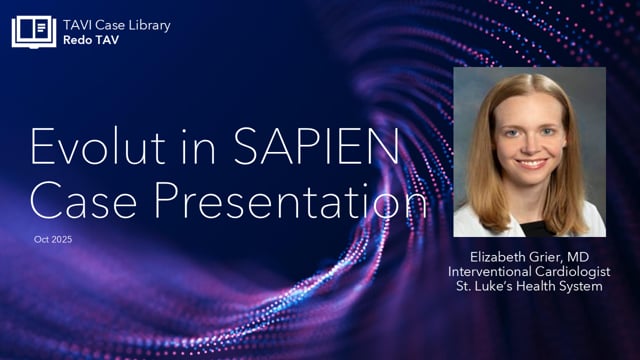 Evolut in Sapien