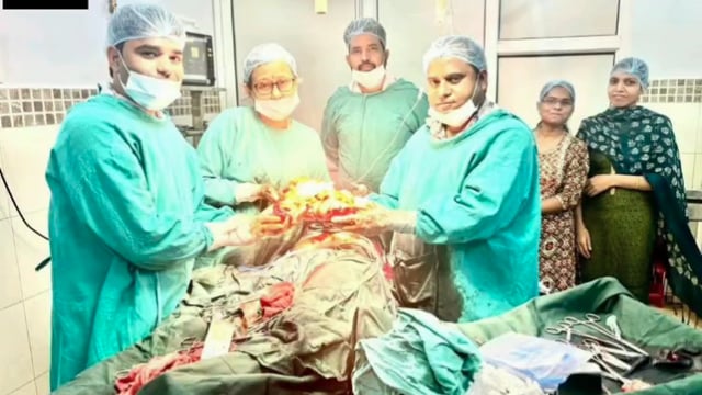 अग्रवाल नर्सिंग  मे डॉक्टर अंकित जैन और उनकी टीम ने 6 किलो वजनी ट्यूमर का किया सफल ऑपरेशन