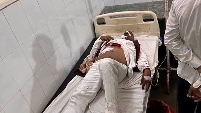 शादी समारोह से लोट रहे कांग्रेस नेता एवं उनके भाई  पर फायरिंग गंभीर घायल  