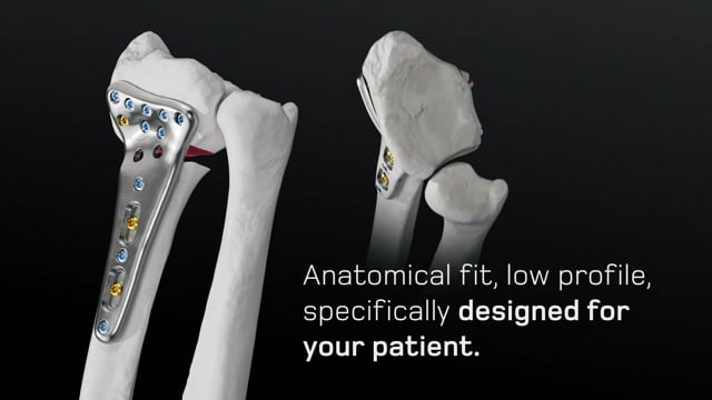 CMX APTUS Concept Trailer