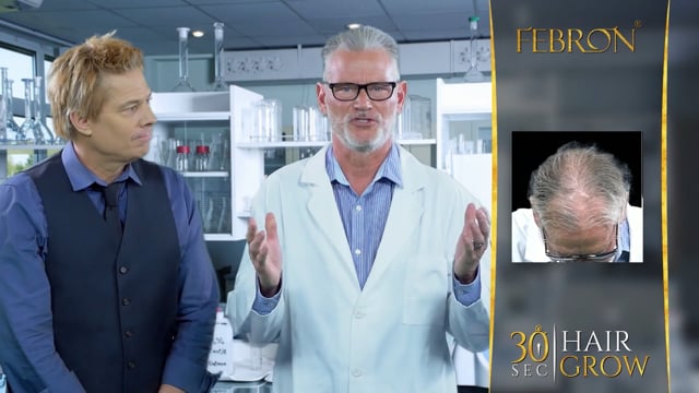 Febron Hair Fibers before and after result showing fuller-looking hair instantly