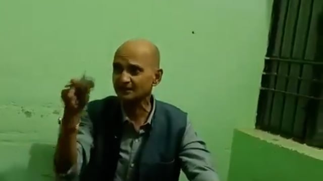 ➡️.....खुलेआम घूस ले रहे हैं और ऊपर से मानसिकता पर ज्ञान दे रहे हैं।*
गोरखपुर के बेलघाट सीएचसी में तैनात डॉक्टर का कथित बयान व्यवस्था की सच्चाई दिखाता है।
*डॉक्टर का कहना है कि वे 35 साल से सेवा में हैं और डॉक्टर की पढ़ाई फ्री में नहीं होती।*