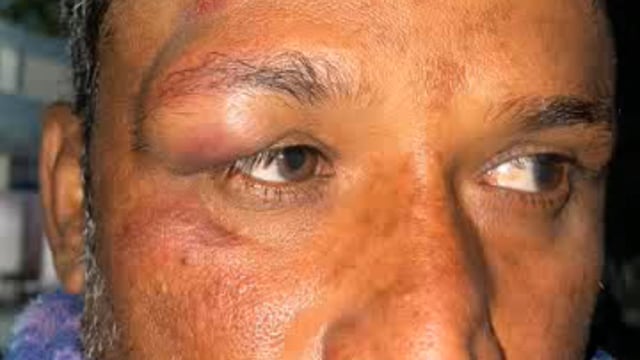 पलिया में बाइक सवार के साथ मारपीट, बाइक छीनने का लगाया आरोप, पुलिस को दी तहरीर