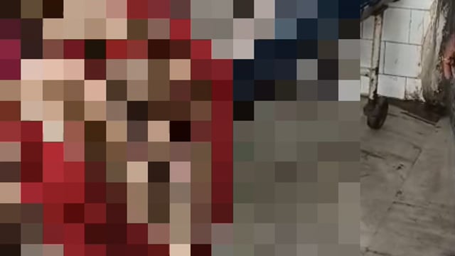 डीजे विवाद में युवक पर धारदार चाकू से हमला, हालत गंभीर,भागलपुर में चल रहा है उपचार।