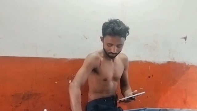 मिठाई लेने गया युवक बना मारपीट का शिकार, दुकानदार ने चेन से किया हमला