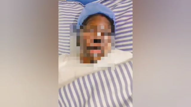 MANT-मथुरा में रिश्तों का खौफनाक चेहरा, बहन को जलाने का आरोप,लेकर SSP कार्यालय पहुंचा, भाई,,