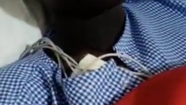 ➡️.....दक्षिण अफ्रीका की अरविका की कानपुर में 3 मार्च को अवैध तरीके से किडनी ट्रांसप्लांट हुई।