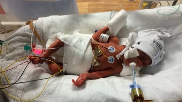 Winnicott Foundation Appeal Film