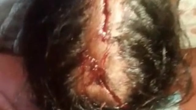 खेत विवाद में घर में घुसकर हमला, महिला की उंगली टूटी, चार के खिलाफ दी तहरीर, एफआईआर कर कार्रवाई की मांग