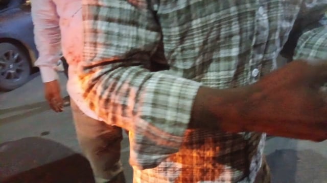 कंठ से जा रहे रोजा बारात में गाड़ी डिवाइडर से टकराई घर वालों को सूचना देते