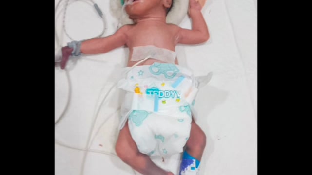 MANT-गोवर्धन CHC में चमत्कार! बिना ऑपरेशन एक साथ तीन बेटों का जन्म, डॉक्टर भी रह गए हैरान”