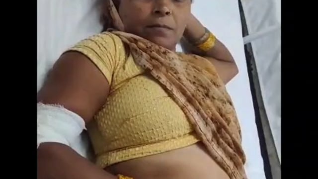  MANT-बंदर बने मौत का खतरा! फरह में फिर हमला, महिला गंभीर घायल,,
