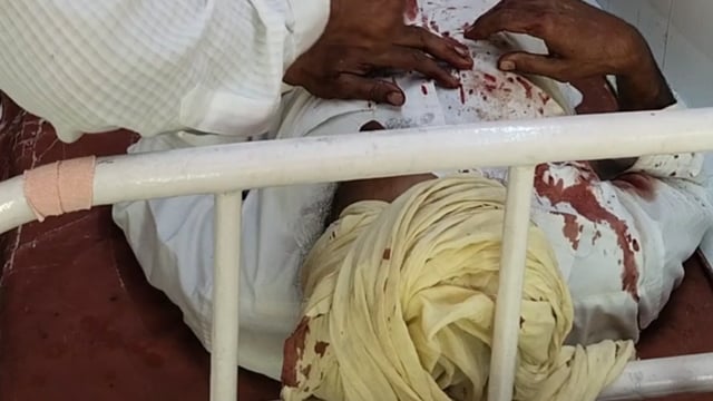 जलालाबाद: स्टेट हाईवे पर दो बाइकों की भीषण टक्कर, छोटू शर्मा और जसपाल सिंह गंभीर गंभीर घायल जिला अस्पताल रेफर
