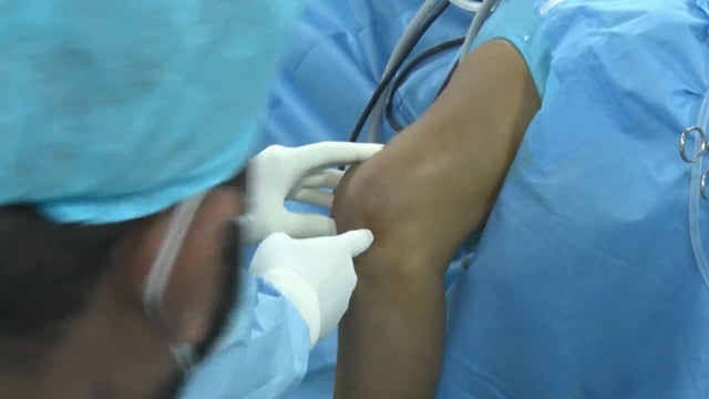 PCL Reconstruction