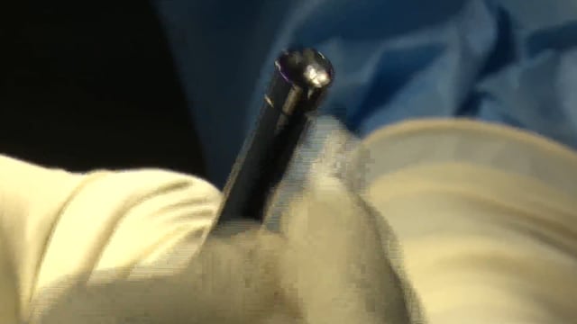 ACL with Quad Tendon
