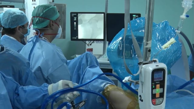 FAI — Arthroscopic Hip Osteoplasty