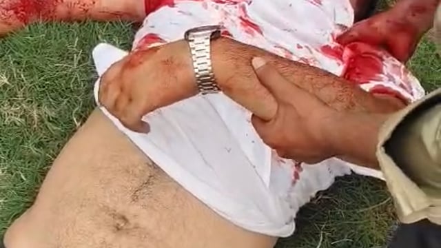 सगाई समारोह में सगे ताऊ के लड़के को गोली मारी,लहूलुहान हालत में अस्पताल में कराया भर्ती।मथुरा की घटना