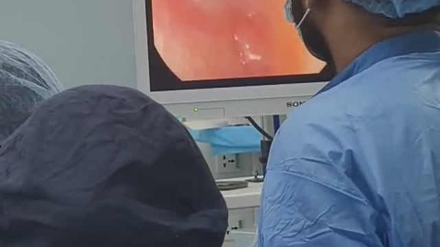 एक रुपयाचं नाणं अशी शस्त्रक्रिया करून बाहेर काढलं 