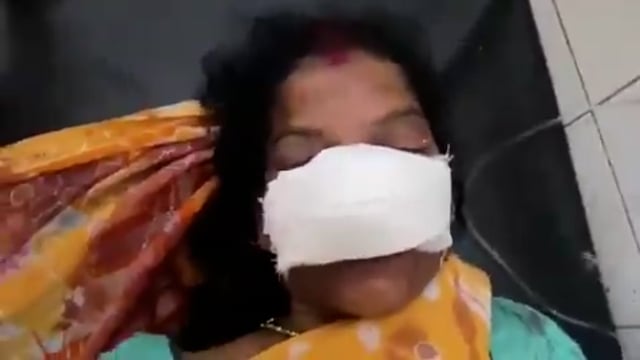 उत्तर प्रदेश के सीतापुर में पत्नी की नाक काटने का आरोप, पति